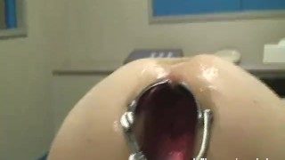 anal fisting and speculum gaping