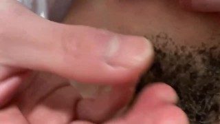 チン毛を燃やしてみた