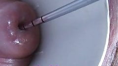 Cervix Fucking with Sounds Cervical Masturbation Utherus