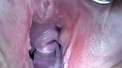Cum Injection with Syringe in Cervix Uterus after Fucking