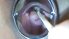 Japanese streamer plays with her cervix